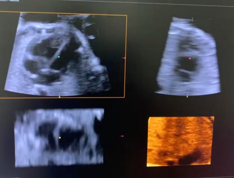 Read more about the article Advanced Fetal Echocardiography at Our Diagnostic Centre